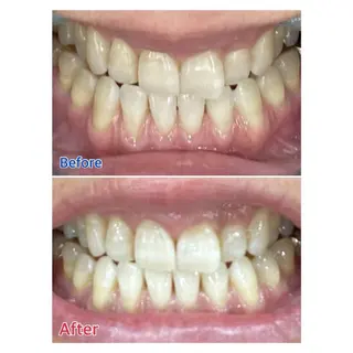 MBEAUTYSALON 千葉店・京成大久保所属・Melty 輝のその他イメージ