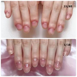 ネイル 深爪を断らない スカルプ高評価店のネイルデザイン