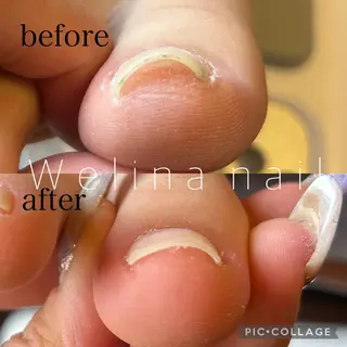 ネイル Welina nailのネイルデザイン