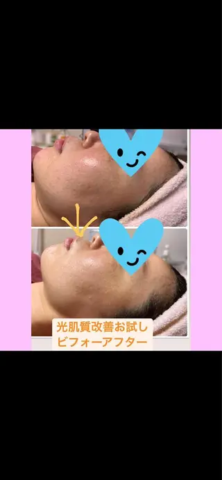 Lien オーナー 山口智嘉のエステ・リラクイメージ