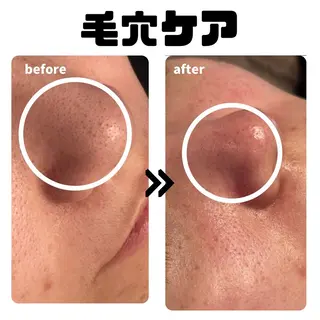 ローザエメ Reiaのエステ・リラクイメージ
