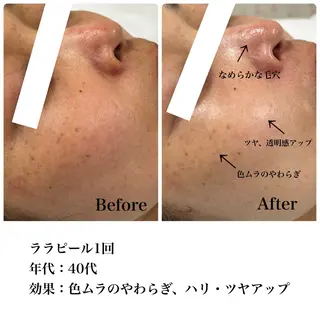 Astorie SHIORIのエステ・リラクイメージ
