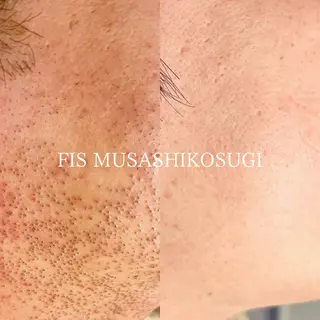 脱毛サロン&ハーブピーリングFIS武蔵小杉店所属・脱毛サロン FIS武蔵小杉店のエステ・リラクイメージ