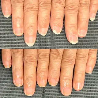 ネイル ステラ marikominoのネイルデザイン