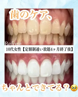 メンズ キッズ ホワイトニング専門店 WHITE天神店のエステ・リラクイメージ