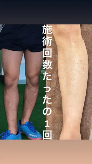 メンズ 都度払い制脱毛サロンBe Charm所属・Be Charm 山﨑のエステ・リラクイメージ