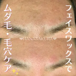 HANASAKURA所属・HANASAKURA 心斎橋のエステ・リラクイメージ