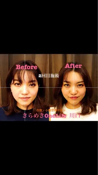 きらめきワンライフ Yumaのエステ・リラクイメージ