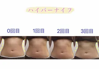 OPREA 栄店のエステ・リラクイメージ