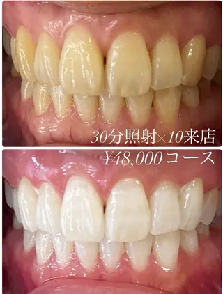 PLATINUM Beauty 横浜店所属・ホワイトニングルーム 横浜店のその他イメージ