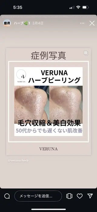 Grandir所属・ハーブピーリング専門 グランディール　武内のエステ・リラクイメージ