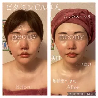 デトックス美容専門サロンpeony所属・デトックス美容専門 サロンpeonyのエステ・リラクイメージ