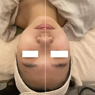 ✨美肌水光✨ アトリエリュバンのエステ・リラクイメージ