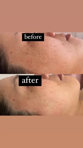 salon＿drop所属・salon dropのエステ・リラクイメージ