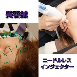 北梅田美容鍼灸院所属・美容鍼マイスター 川村　淳のエステ・リラクイメージ