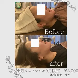 肌質改善サロン🌻 Nico laughのエステ・リラクイメージ