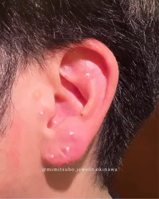 Jewelit所属・耳つぼジュエリー Jewelitのその他イメージ