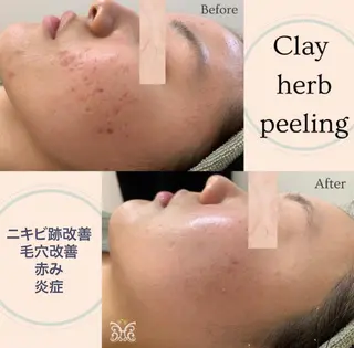 美肌&アロマ🌙 nana 目白/池袋のエステ・リラクイメージ