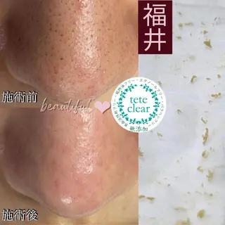 毛穴ケア専門サロン Yourmeユアミーのエステ・リラクイメージ