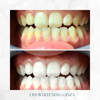 メンズ LBSホワイトニング 銀座店💎公式のその他イメージ