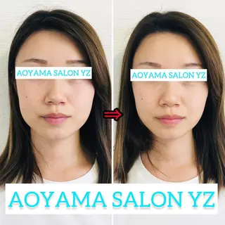 小顔美容鍼専門サロン 渋谷YZのエステ・リラクイメージ