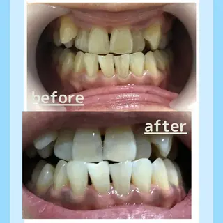 メンズ お手軽ホワイトニングsalon mina所属・武元 奈津美のその他イメージ