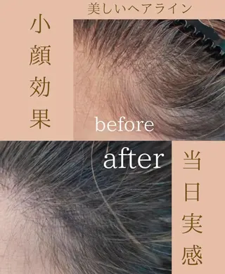 W eye+東口店/ SCALP INKのマツエク・マツパデザイン