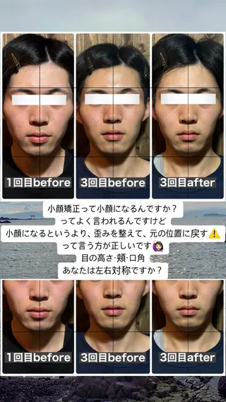 💎後悔させない小顔 矯正💎イトヤマ🌱のエステ・リラクイメージ