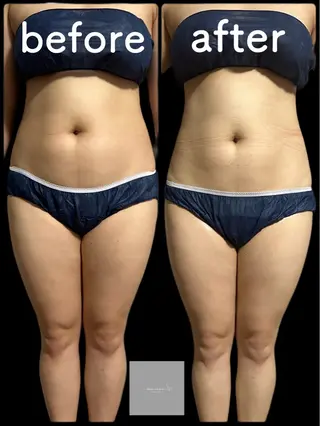 marron所属・痩身ハイパーナイフ ララピールリアボーテのエステ・リラクイメージ