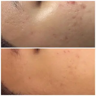 触れたくなる モテ肌へ...❤︎のエステ・リラクイメージ