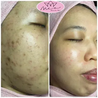 Mia beauty所属・MiA Beautyのエステ・リラクイメージ
