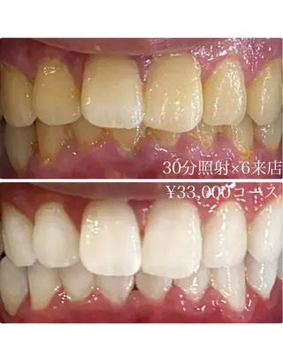 メンズ ホワイトニングルーム 川崎店所属・ホワイトニング ルーム 川崎店のその他イメージ