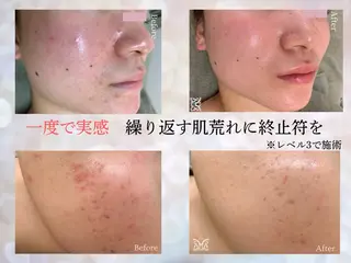 VIKI BEAUTY  クレイハーブピーリング・美肌脱毛専門店所属・VIKI BEAUTYのエステ・リラクイメージ