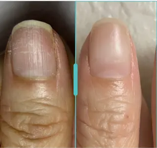 ネイル 深爪・自爪育成専門 MAHALOHIのネイルデザイン