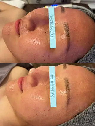 ☆痩身/小顔☆ 結果出します☆のエステ・リラクイメージ