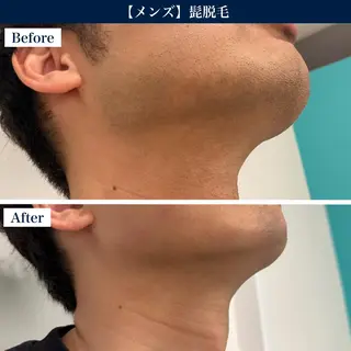 【メンズ脱毛・美肌】 SARA 恵比寿店のエステ・リラクイメージ