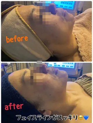 TEIKOKU所属・トータルビューティー TEIKOKUのエステ・リラクイメージ