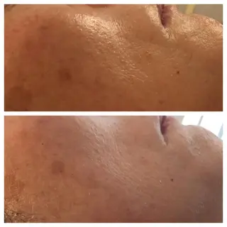 痩身専門サロン ビューティーグランツのエステ・リラクイメージ