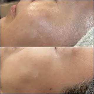 LiZA エステティックサロンのエステ・リラクイメージ