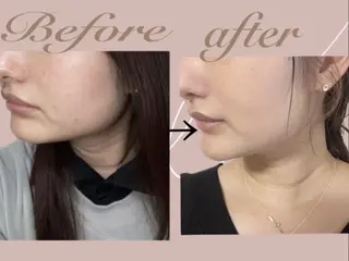 温活痩身サロン ヨサパークリリーのエステ・リラクイメージ