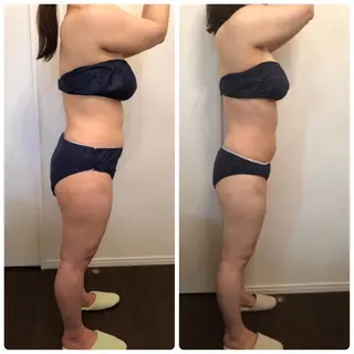 FLEUR大阪・美容 整体・痩身・小顔のエステ・リラクイメージ