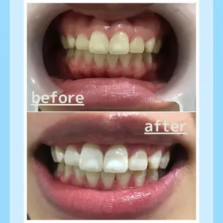 メンズ お手軽ホワイトニングsalon mina所属・武元 奈津美のその他イメージ