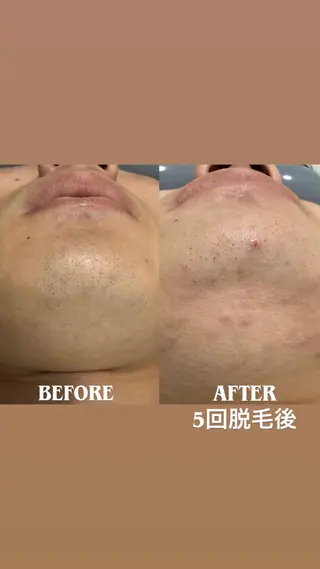 More   Beauty所属・More Beautyのエステ・リラクイメージ