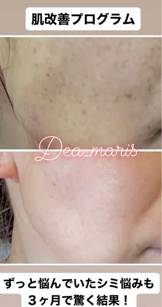 private salon  Dea_maris シュガーリング＆パーソナルボディケア所属・シミ改善・韓国肌管理 ボディメイク痩身のその他イメージ