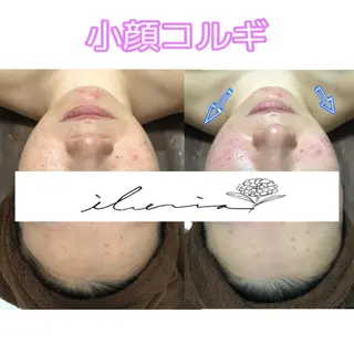 心斎橋痩身ダイエット 韓国.美容鍼.小顔のエステ・リラクイメージ