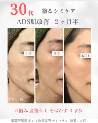 private salon  Dea_maris シュガーリング＆パーソナルボディケア所属・ダイエット難民が通う 10キロダイエットのエステ・リラクイメージ