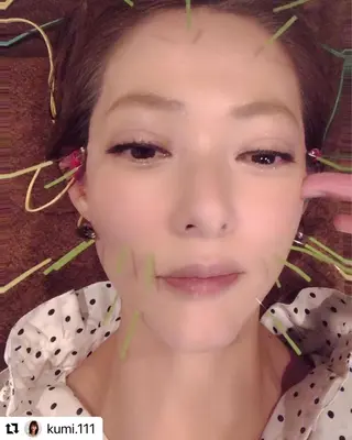 メンズ 美容鍼灸サロン LOMIHARIのエステ・リラクイメージ