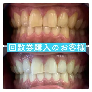 PLATINUM Beauty 横浜店所属・ホワイトニングルーム 横浜店のその他イメージ