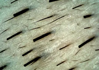 Hit. シュガーリング豊橋のエステ・リラクイメージ