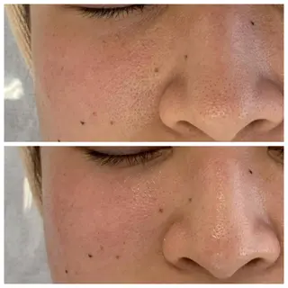 小顔&デコルテ Spa “koti”のエステ・リラクイメージ